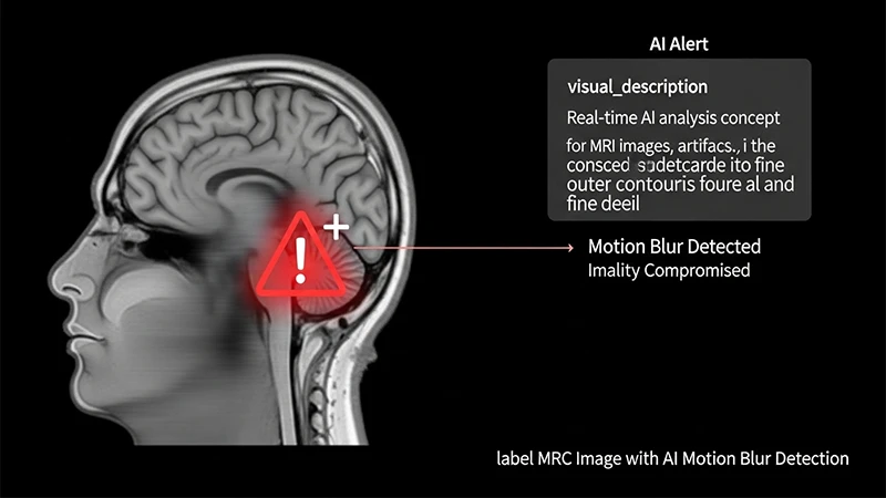 A diagram showing an AI flagging a motion artifact on an MRI in real-time for the technologist.