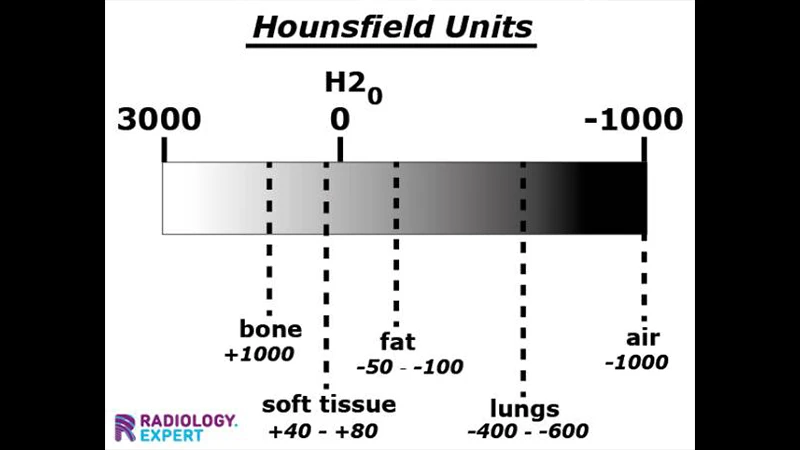 CT slice of an abdomen with labels pointing to bone, liver, and fat, showing their different Hounsfield Unit values