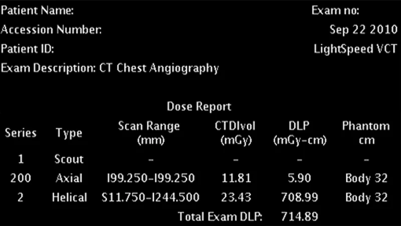 An example of a CT radiation dose report page showing CTDIvol and DLP values.