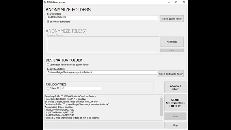 A screenshot of a software interface showing options for DICOM anonymization, like removing tags and blacking out burned-in annotations.