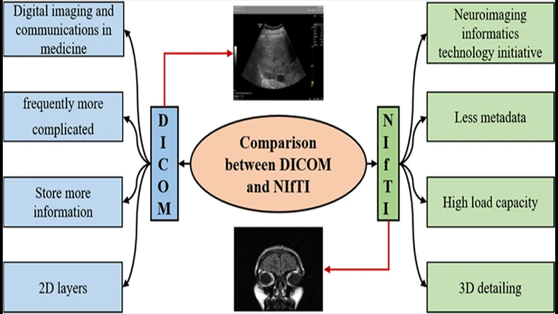 A diagram comparing the DICOM structure (many files for one scan) to the NIfTI structure (one file for one scan).