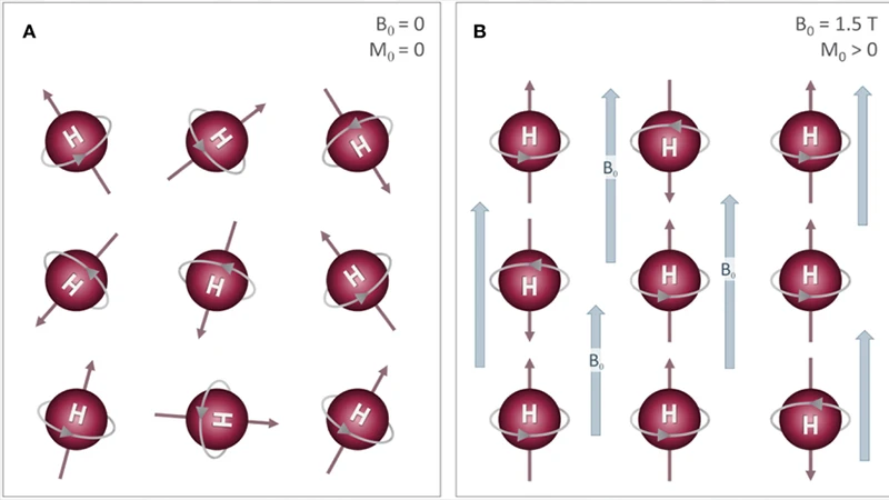 Diagram showing protons randomly aligned, then aligned in a magnetic field, and then excited by an RF pulse