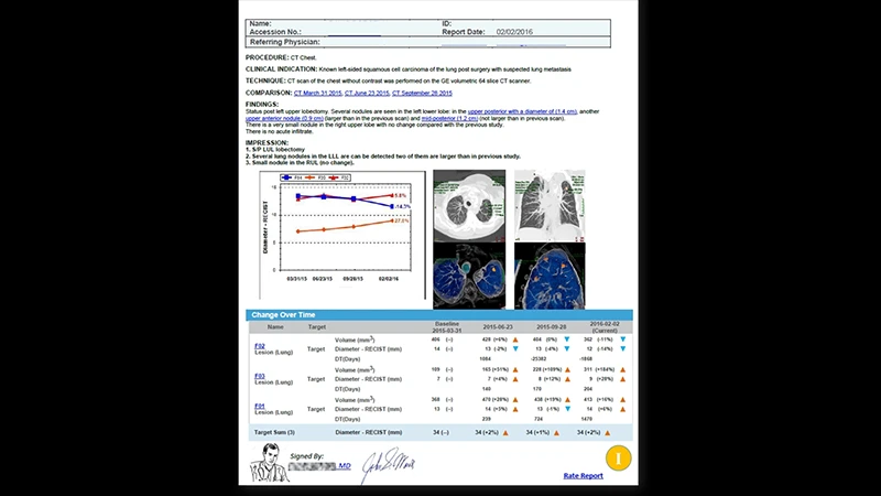 An example of a radiology report with the Findings and Impression sections highlighted.