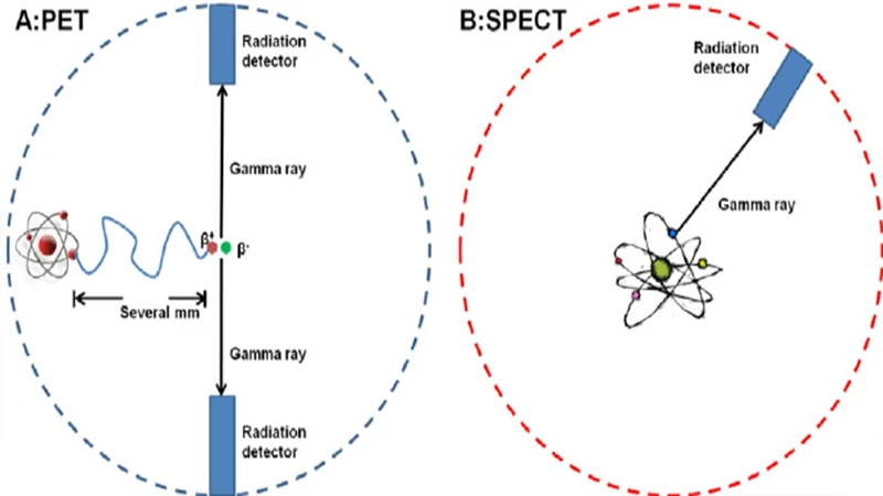 A simplified diagram comparing SPECT (detecting single photons) and PET (detecting pairs of photons)