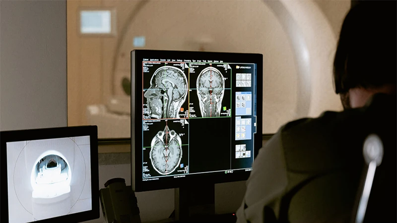 A radiology technologist operating the console of an MRI machine, with images on the screen.
