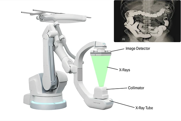 A C-arm fluoroscopy machine in an operating room