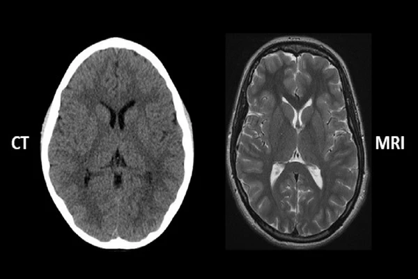 A split image of a CT and MRI scanner