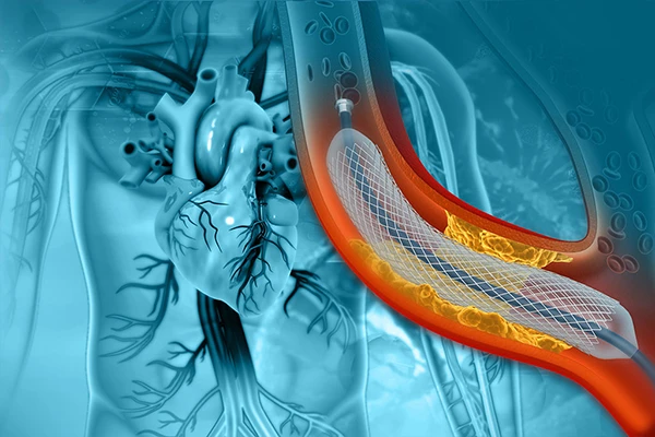 A physician working with a C-arm