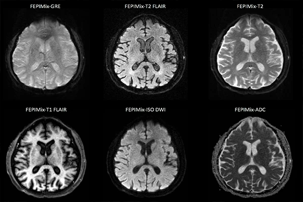 Montage of T1, T2, FLAIR images