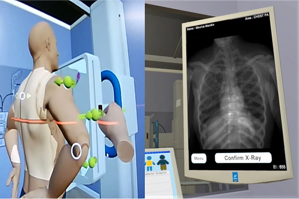 A diagram of a patient being positioned for an x-ray