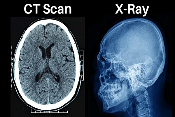 A split image of an x-ray machine and a CT scanner