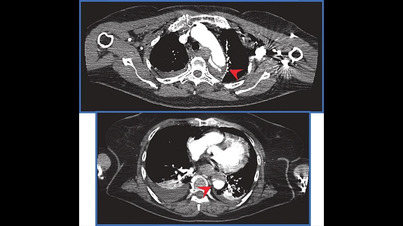 A montage of CT images from a trauma pan-scan, showing slices from the head, chest, and abdomen.