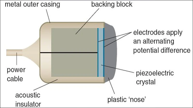 Diagram showing an ultrasound transducer emitting sound waves and receiving echoes to create an image